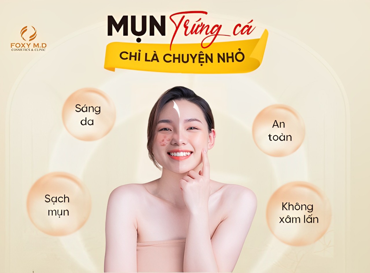 Phòng khám Da liễu Thẩm mỹ Foxy M.D – Địa chỉ trị mụn uy tín tại Đà Nẵng